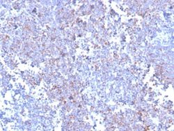 SOX11 Antibody (SOX11/3235R) - Azide and BSA Free, Novus Biologicals 100